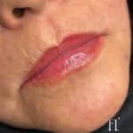 Hydra Gloss + coloração